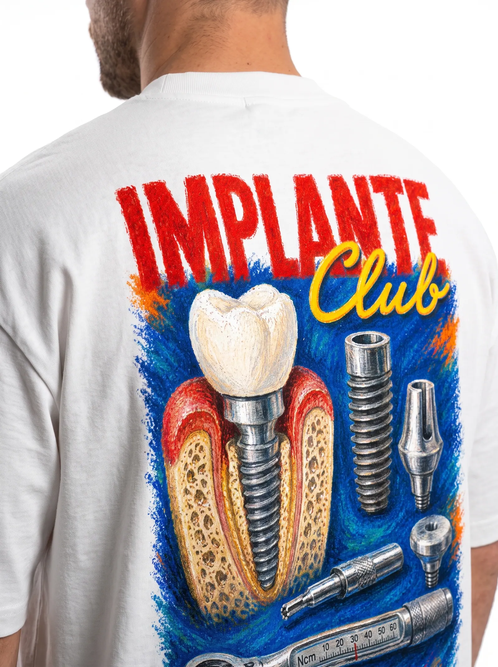 Implante Club · foto 5